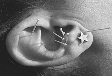 Acupuntura, oreja, puntos